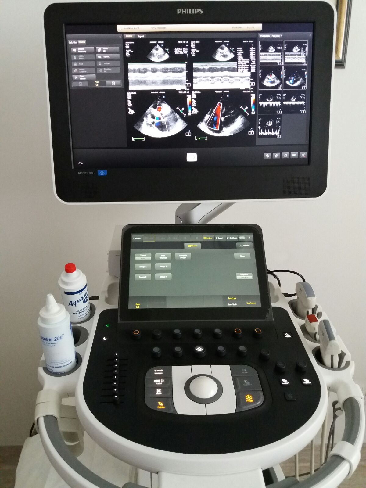 Kardiološki ultrazvučni aparat