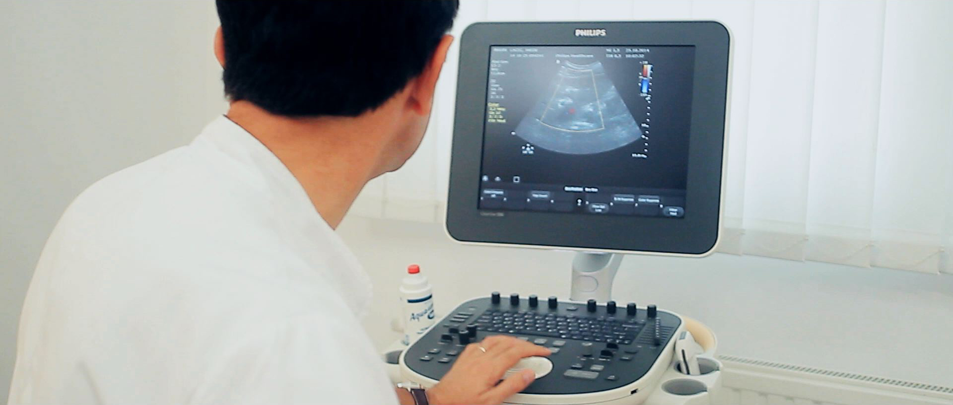 Ultrazvuk abdomena